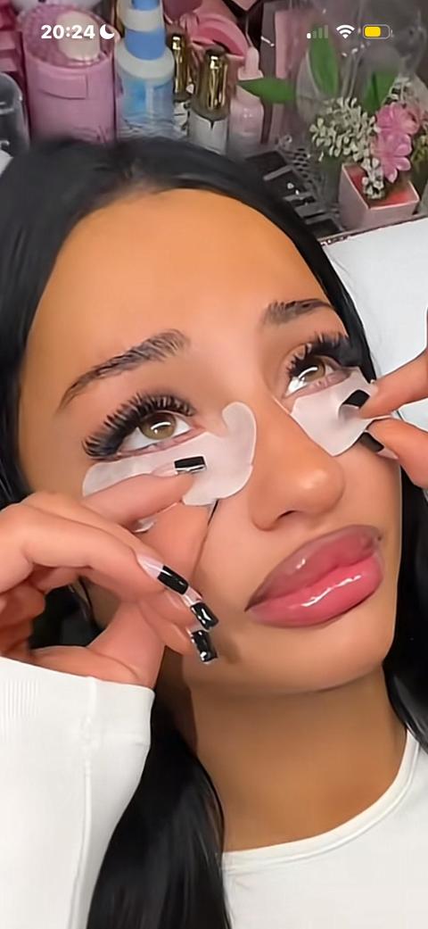 Suche Zahlsklave für Lippenunterspritzung